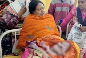 Фотография к новости: В Индии появился на свет младенец с двумя парами рук и ног