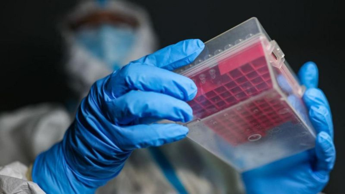 Hu Yuanjia/VCG/Getty Images