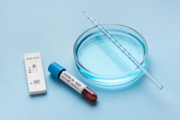 Фотография к новости: Меньше 600 новых случаев коронавируса зафиксировали в Казахстане