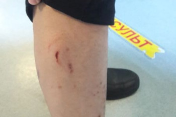 Фотография к новости: Бродячие собаки напали на нескольких жителей Тараза