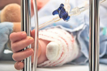 Фотография к новости: Несколько пластических операций перенёс ребёнок, которого поджёг сосед в Рудном