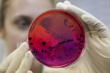 Фотография к новости: Больного сибирской язвой выявили в поезде, следовавшем в Боровое