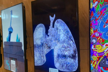 Фотография к новости: В Казахстане представили первую NFT-коллекцию о посмертном донорстве. Что это и зачем нужно?