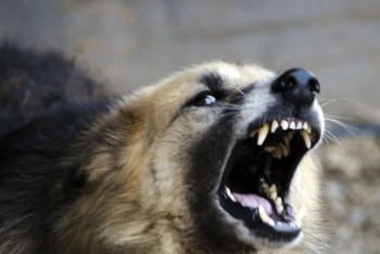 Фотография к новости: Собака укусила в лицо пятилетнюю девочку в Атырау