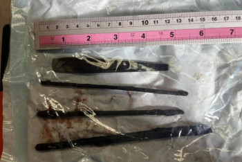 Фотография к новости: Обрезки арматуры проглотил молодой человек в Актау