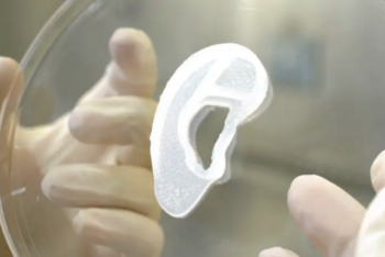 Фотография к новости: Пациенту пришили ухо, напечатанное на 3D-принтере