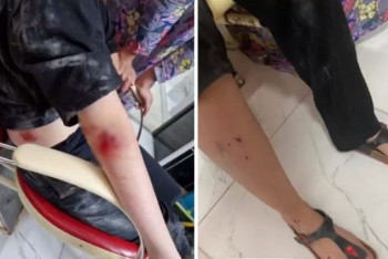 Фотография к новости: Свора собак напала на девочку в Жанаозене