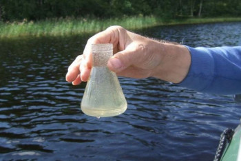 Фотография к новости: Бактерии холеры обнаружили в водоёмах ЗКО
