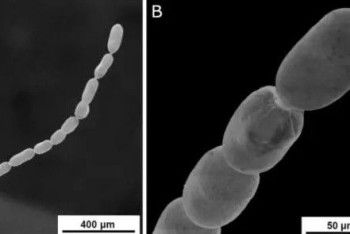 Фотография к новости: Обнаружена самая большая бактерия в мире длиной до двух сантиметров