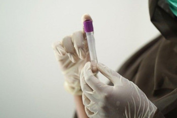 Фотография к новости: Вдвое возросли показатели суточной ковид-статистики в РК