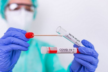 Фотография к новости: Более 400 новых случаев коронавируса выявили за сутки в РК