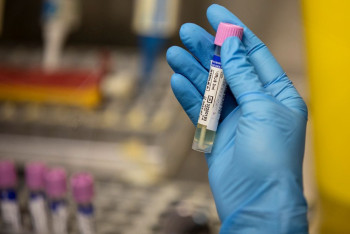 Фотография к новости: Житель США одновременно заразился коронавирусом и оспой обезьян