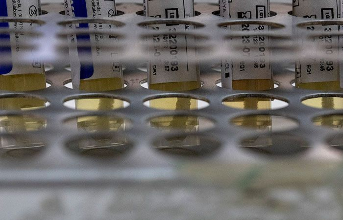 Pablo Blazquez Dominguez/Getty Images