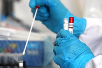 Фотография к новости: 2713 новых случаев коронавирусной инфекции выявили за сутки в Казахстане