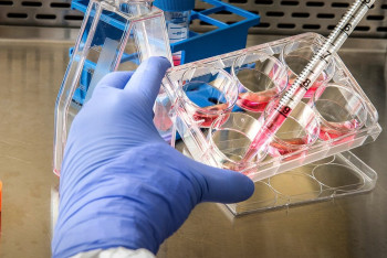 Препарат против оспы обезьян могут включить в протокол лечения в Казахстане