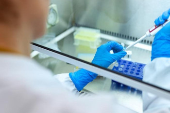 Фотография к новости: Суточная заболеваемость коронавирусной инфекцией в Казахстане осталась на прежнем уровне