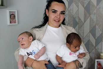 Фотография к новости: Двойняшки с разным цветом кожи родились в Британии