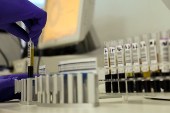 Фотография к новости: За сутки в Казахстане выявили 328 новых случаев Covid-19