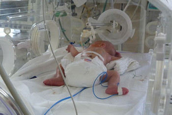 Фотография к новости: О состоянии найденного в туалете младенца рассказали врачи в Алматы