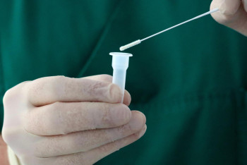 Фотография к новости: Ситуация с КВИ в Казахстане стабилизировалась