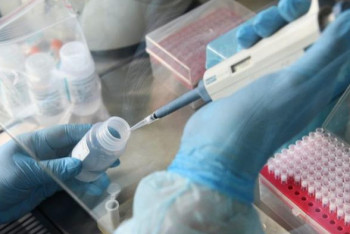 Фотография к новости: Более 200 человек заразились КВИ за сутки в Казахстане