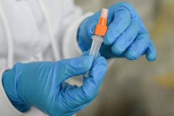 Фотография к новости: За сутки у 365 человек выявили коронавирус в Казахстане