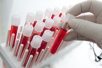 Фотография к новости: Около 1500 пациентов с онкологией кроветворной и лимфатической ткани регистрируют ежегодно в РК