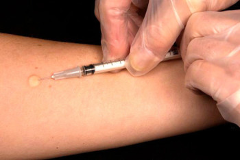 Фотография к новости: "Туберкулёзом дети не заболеют": глава Минздрава прокомментировала путаницу с вакциной