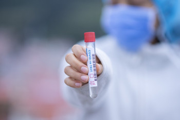 Фотография к новости: 50 казахстанцев заболели коронавирусом за сутки