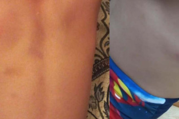 Фотография к новости: Воспитатель избила ребёнка в детсаду Павлодара