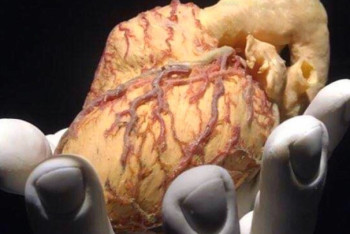 Фотография к новости: Как оформить согласие или отказ на посмертное донорство органов, рассказали в Минздраве