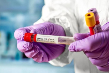 Фотография к новости: COVID-19 за сутки заразились 66 казахстанцев