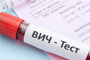 Фотография к новости: В Алматы растёт число случаев передачи ВИЧ половым путём