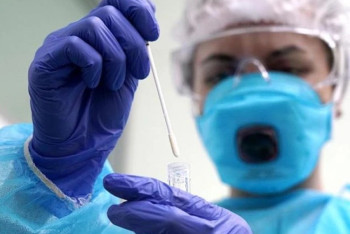 Фотография к новости: COVID-19 за сутки подтвердился у 85 казахстанцев