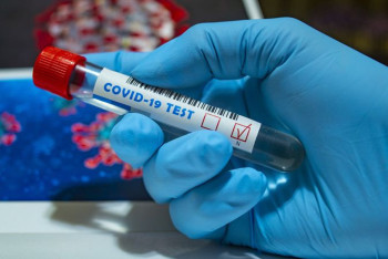 Фотография к новости: Рост заражения коронавирусом зарегистрировали в Казахстане