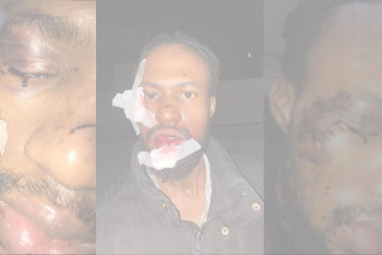 Фотография к новости: Гражданина Нигерии избили в Шымкенте