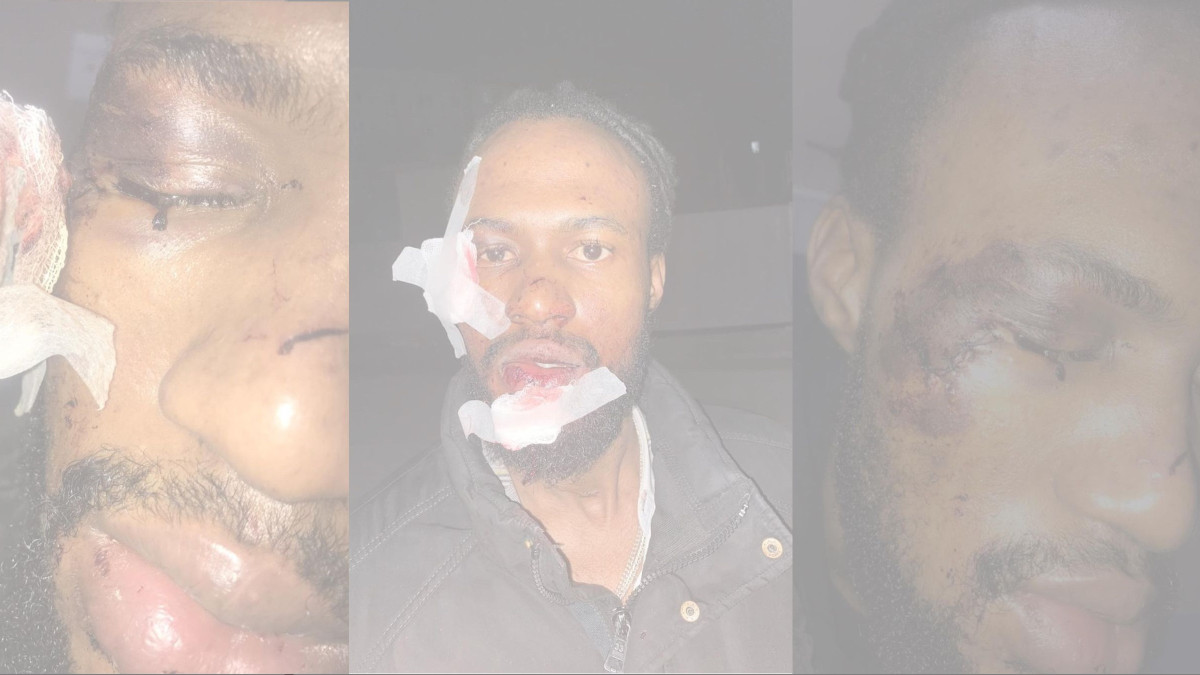 Гражданина Нигерии избили в Шымкенте