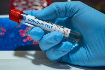 Фотография к новости: До 235 выросло число заразившихся казахстанцев коронавирусом 13 декабря