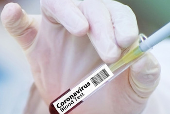 Фотография к новости: 139 казахстанцев заразились коронавирусом за сутки