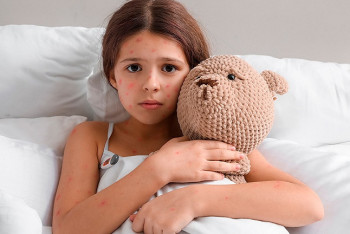 Фотография к новости: Вдвое увеличилось число случаев скарлатины и ветрянки в Казахстане