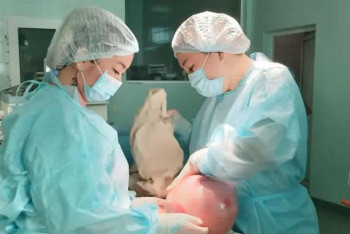 Фотография к новости: 8-килограммовую миому удалили у женщины в Атырау