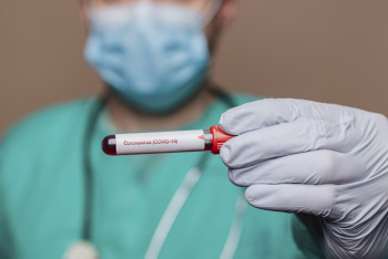 Фотография к новости: 66 новых заражённых коронавирусом выявили в Казахстане