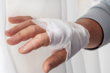 Фотография к новости: В Шымкенте мужчина получил ожоги, спасая жену и детей из огня