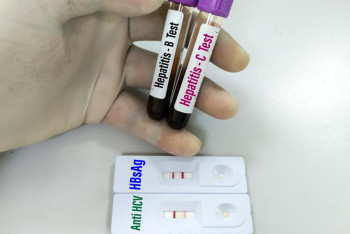 Фотография к новости: Пилотную программу по предупреждению гепатитов запустили в Астане