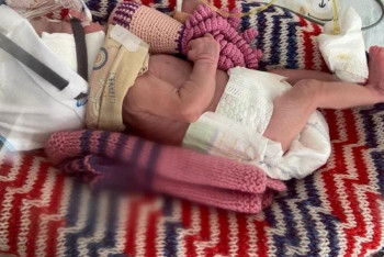 Фотография к новости: 112 дней казахстанские врачи боролись за малышку весом 998 граммов