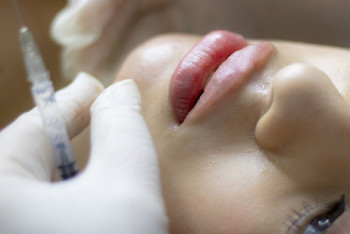 Фотография к новости: "Углы Джоли", блефаропластика и филлеры: каковы риски в погоне за красотой