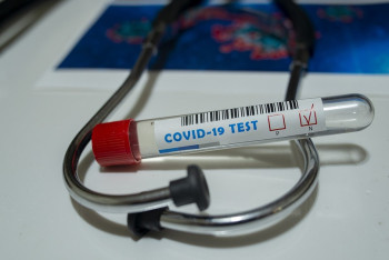 Фотография к новости: 33 новых заражённых COVID-19 выявили в Казахстане