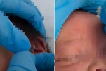 Фотография к новости: Медсестру наказали за проведение хиджамы на младенце в Атырауской области