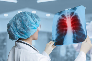 Фотография к новости: В Алматы туберкулёзом больше всего болеют безработные