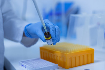 Фотография к новости: В Казахстане за сутки выявлено 27 случаев COVID -19